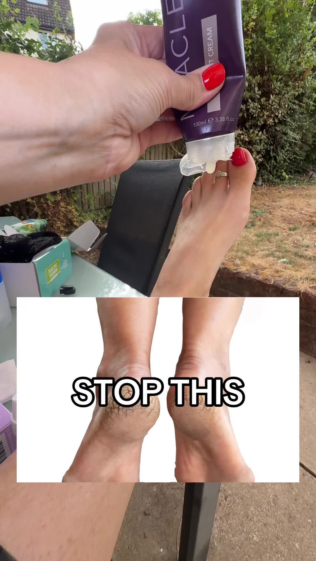 TikTok post by @sharonshops for Margaret Dabbs. Caption reads: Please stop with minging feet 🦶@Margaret Dabbs....
