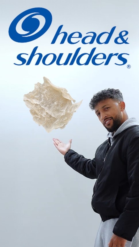 Instagram post by @mattgreen.jgm for Head & Shoulders North America. Caption reads: The science of dandruff explained the way I do it!....