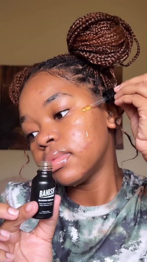 Instagram post by @oratilemororo for Banish. Caption reads: The banisher 3.0 + @banish Dark spot corrector is....