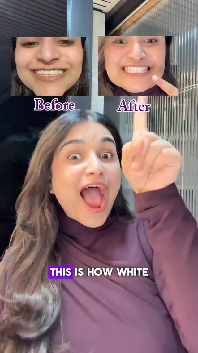 Instagram post by @harshika_varshneyy for Closeup. Caption reads: Honestly my smile has never looked so....