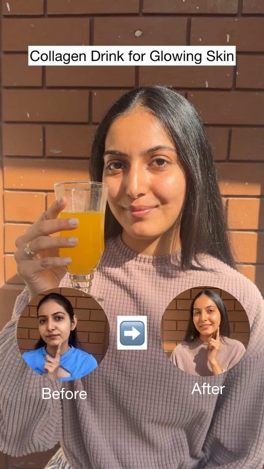 Instagram post by @stunner_skincare for HK Vitals. Caption reads: Agar aapki skin bhi dull dehydrated hogai hai,....