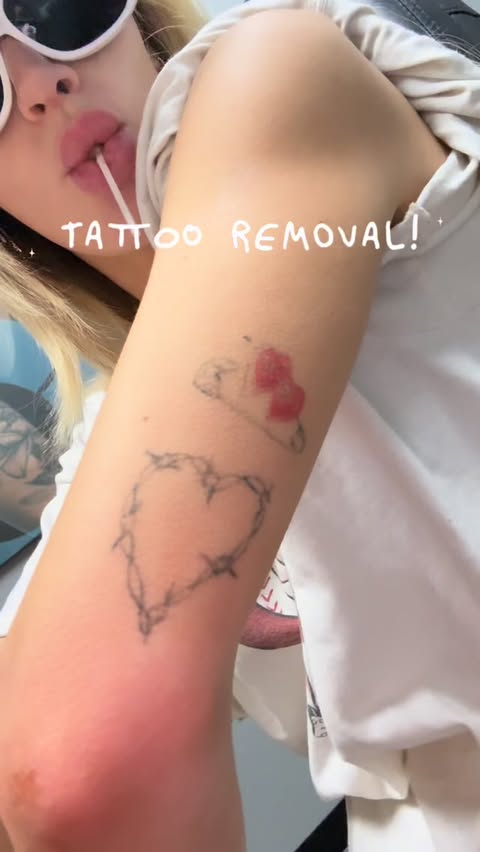 Instagram post by @madimonroe for Removery. Caption reads: @removery fixing my mistakes :’).