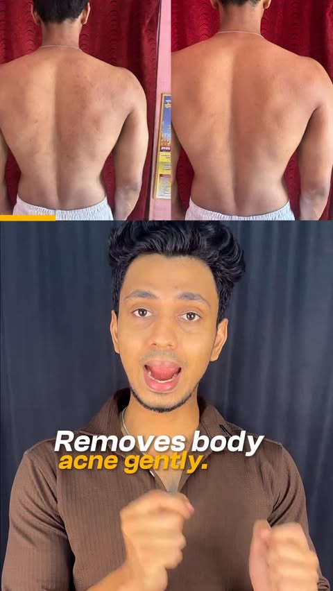 Instagram post by @sudharsan_lifestyle for Foxtale. Caption reads: Reduce ur body acne in just 28 days 👍 #bodywash....