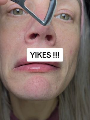 TikTok post by @brandyinreallifex4 for Beplain US. Caption reads: I was shocked this took so much gunk off my nose....