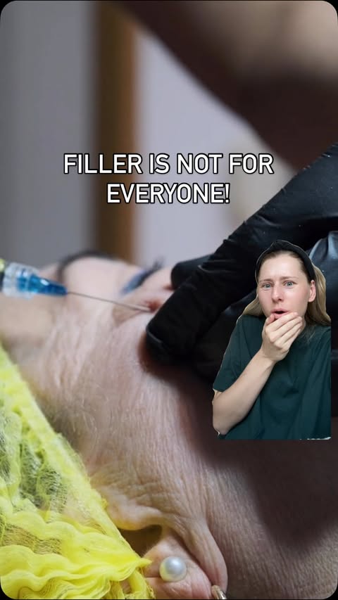 Instagram post by @majnar for COSRX. Caption reads: #COSRXpartner Why is my skin so hallow, why is....
