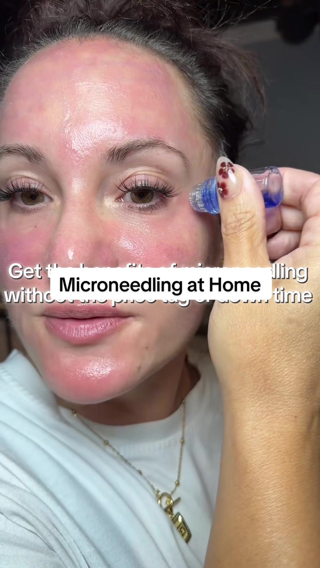 TikTok post by @niya_rn0 for Qure Skincare. Caption reads: [...] decrease acne scarring. @Qure Skincare....