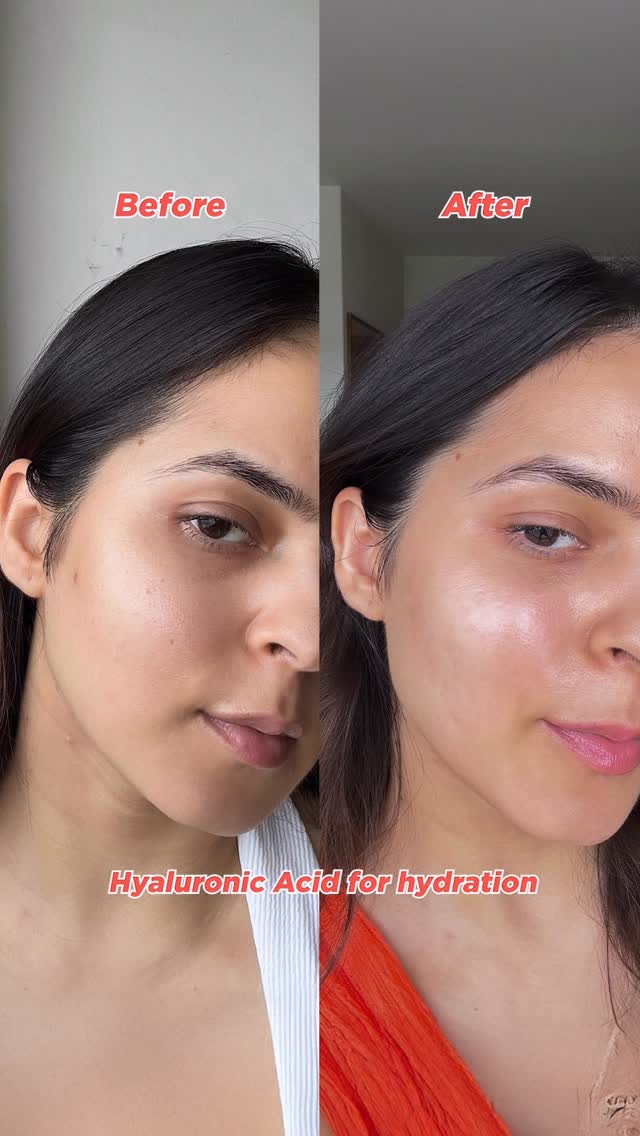 Instagram post by @palaksindhwani for Plum Goodness. Caption reads: When your skin becomes the main character ✨
Been....