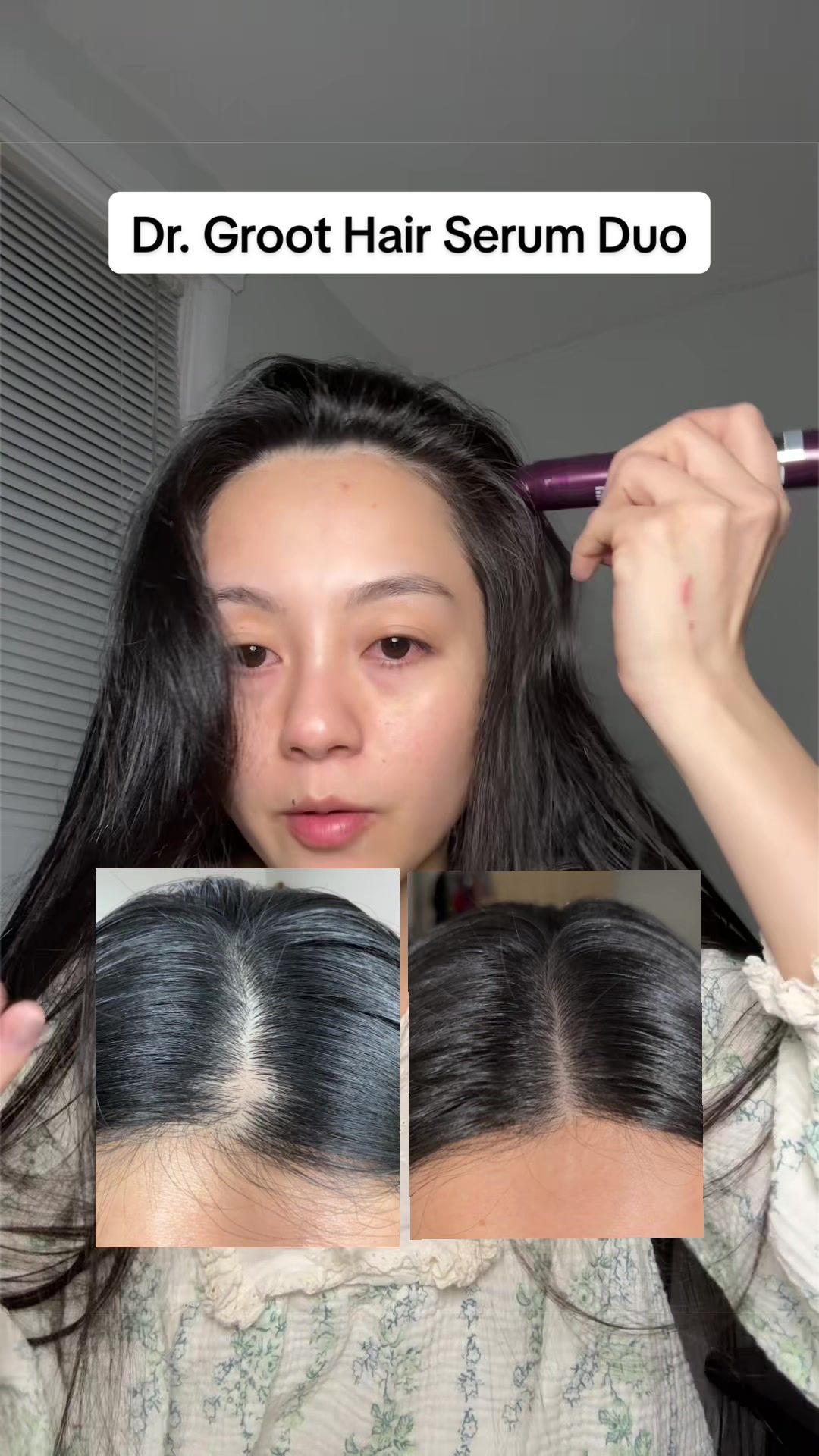TikTok post by @nphiynhi for LG BEAUTY. Caption reads: [...] @Dr. Groot Hair @LGbeauty US.