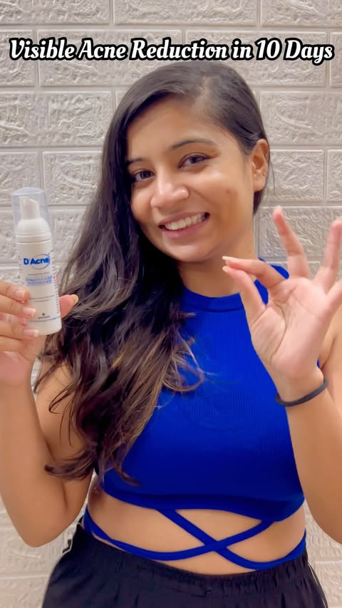 Instagram post by @the.blessed.gurl for D'Acne by Glenmark. Caption reads: If acne, excess oil, or breakouts are a regular....