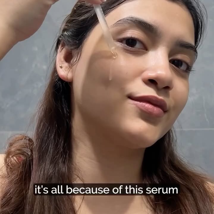 Instagram post by @muskanaggarwalofficial for SkinKraft. Caption reads: Skincare but according to your skin 😍 A BIG YESS....