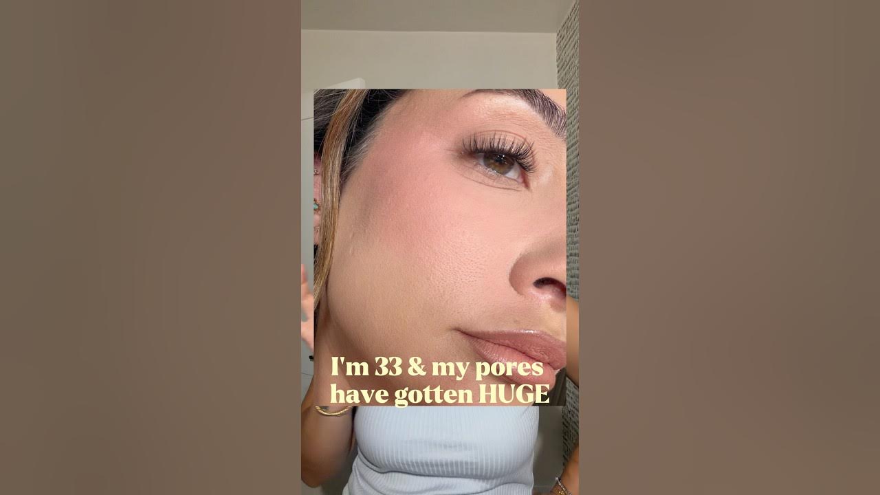 YouTube post by @NicolConcilio for DRMTLGY. Caption reads: [...] scars, these Daily Peel Pads from @DRMTLGY....