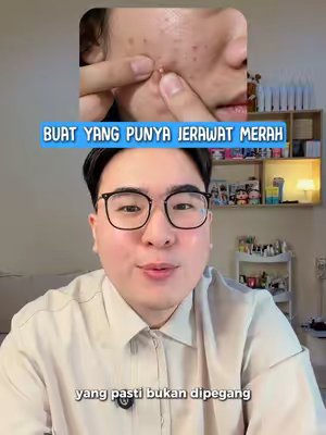 TikTok post by @dr.giovanniabraham for Nurilab.id. Caption reads: [...] conclearing acne dry lotion dari @Nurilab.id....