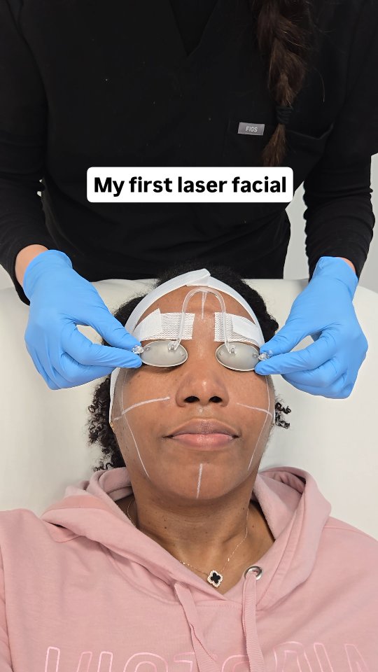 Instagram post by @longhairprettynails for LaserAway. Caption reads: My first laser facial at @laseraway in The Gulch....