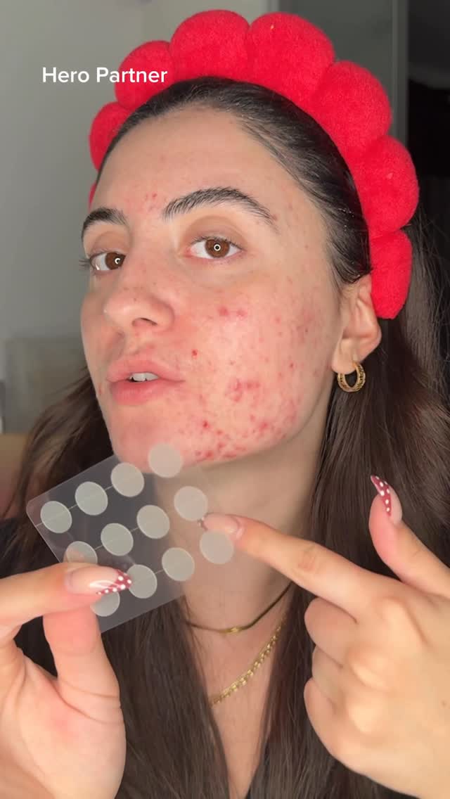 Instagram post by @laviniarusanda for Hero Cosmetics. Caption reads: breakouts happen... but my go to patch to avoid....