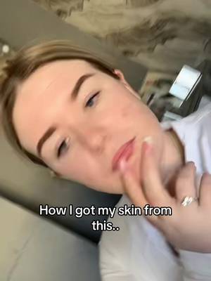 TikTok post by @taylorguidon0 for ISOCLEAN Ireland. Caption reads: The Isoskin Thermaglow saved my skin 😍....