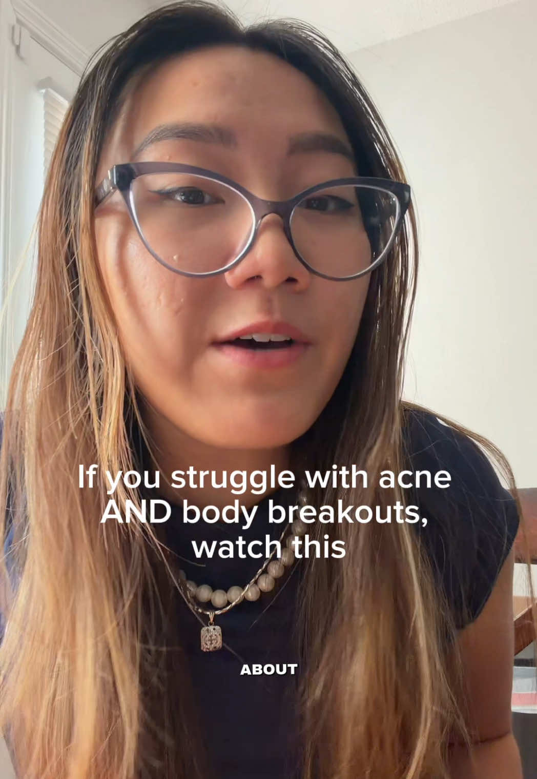 TikTok post by @tammypandas for MyMagicHealer. Caption reads: [...] you need to see this 👀😭 The MyMagicHealer....