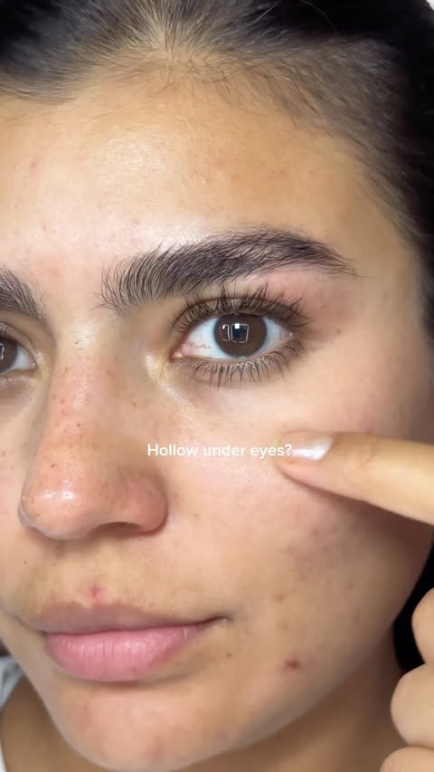 Instagram post by @mercedesmonje_ for Biodance. Caption reads: My new go-to for tired under eyes✨....
