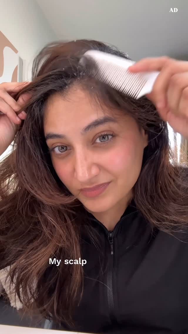 Instagram post by @nilamparmarr for Indulekha. Caption reads: My scalp was literally snowing... and nothing....