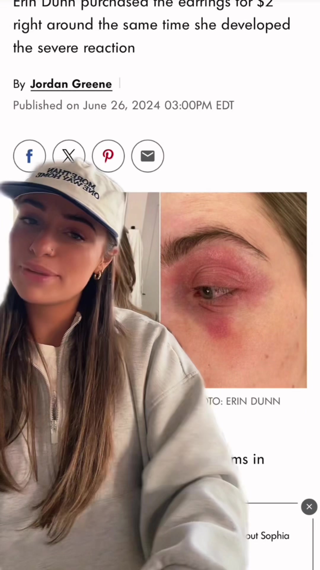 TikTok post by @formervegetarian for Tini Lux. Caption reads: [...] @mandasundem eczema response!! thanks @Tini....