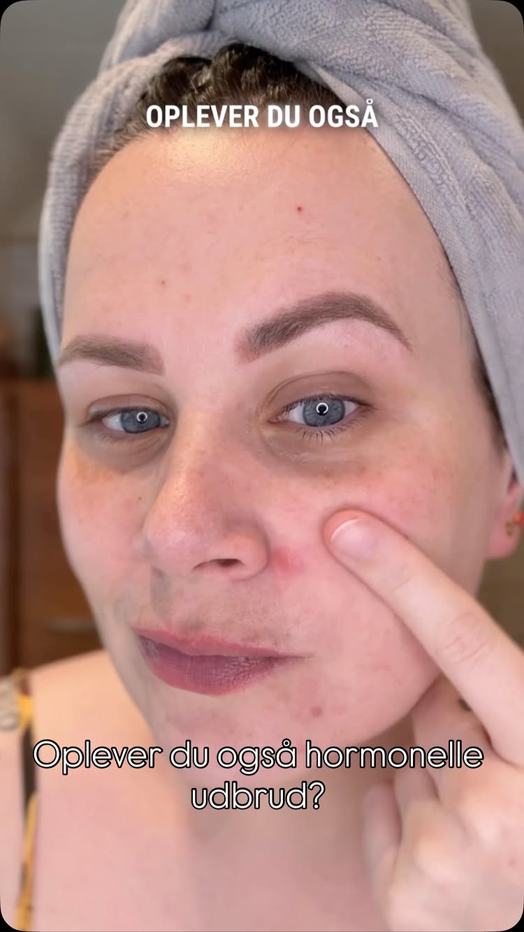 Instagram post by @mette_milan for Ducray. Caption reads: Reklame @ducraydanmark
 
Måske oplever du det....