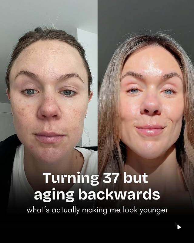 Instagram post by @celestethomas for Sleep&Glow. Caption reads: No Botox, filler, or lasers! At home practices....