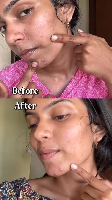 Instagram post by @vj_sakthijanani_ for GHAR SOAPS. Caption reads: Acne reducing facewash @gharsoaps . . #Skincare....