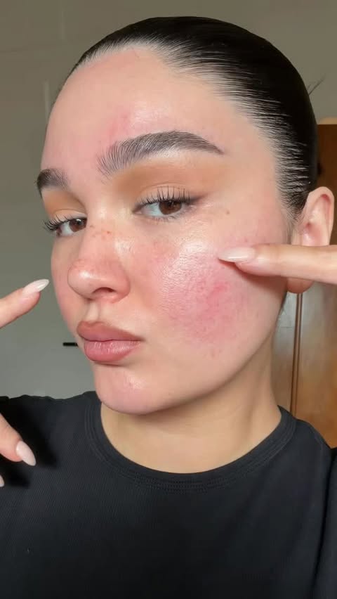 Instagram post by @madibernard for LAWLESS Beauty. Caption reads: rosacea can be tricky to work with, but i know i’m....