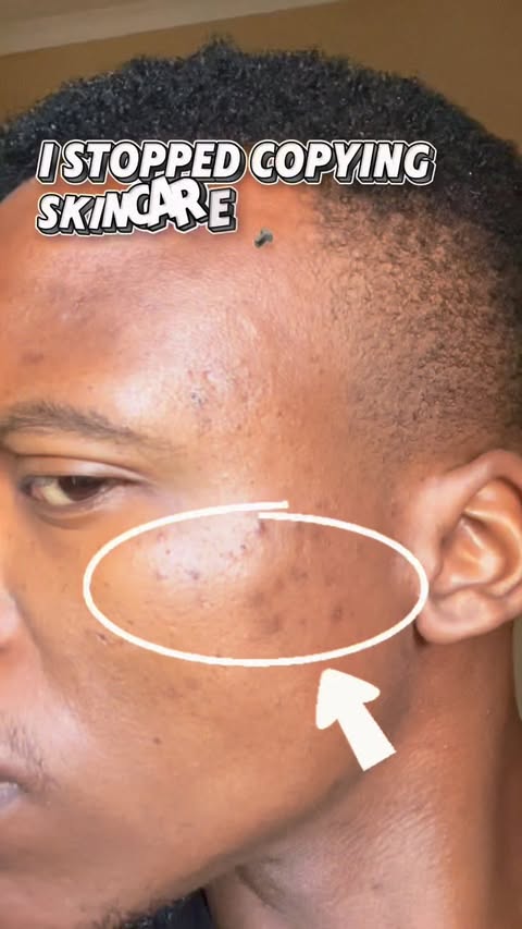 Instagram post by @sthembisomkhatshwa_ for NIVEA South Africa. Caption reads: I stopped chasing every skincare trend and decided....
