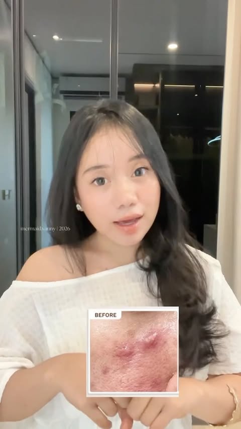 Instagram post by @mermaid.vanny for ELSHESKIN. Caption reads: [...] Fighter Sini Kumpul 🔎👀 [New Launch]....