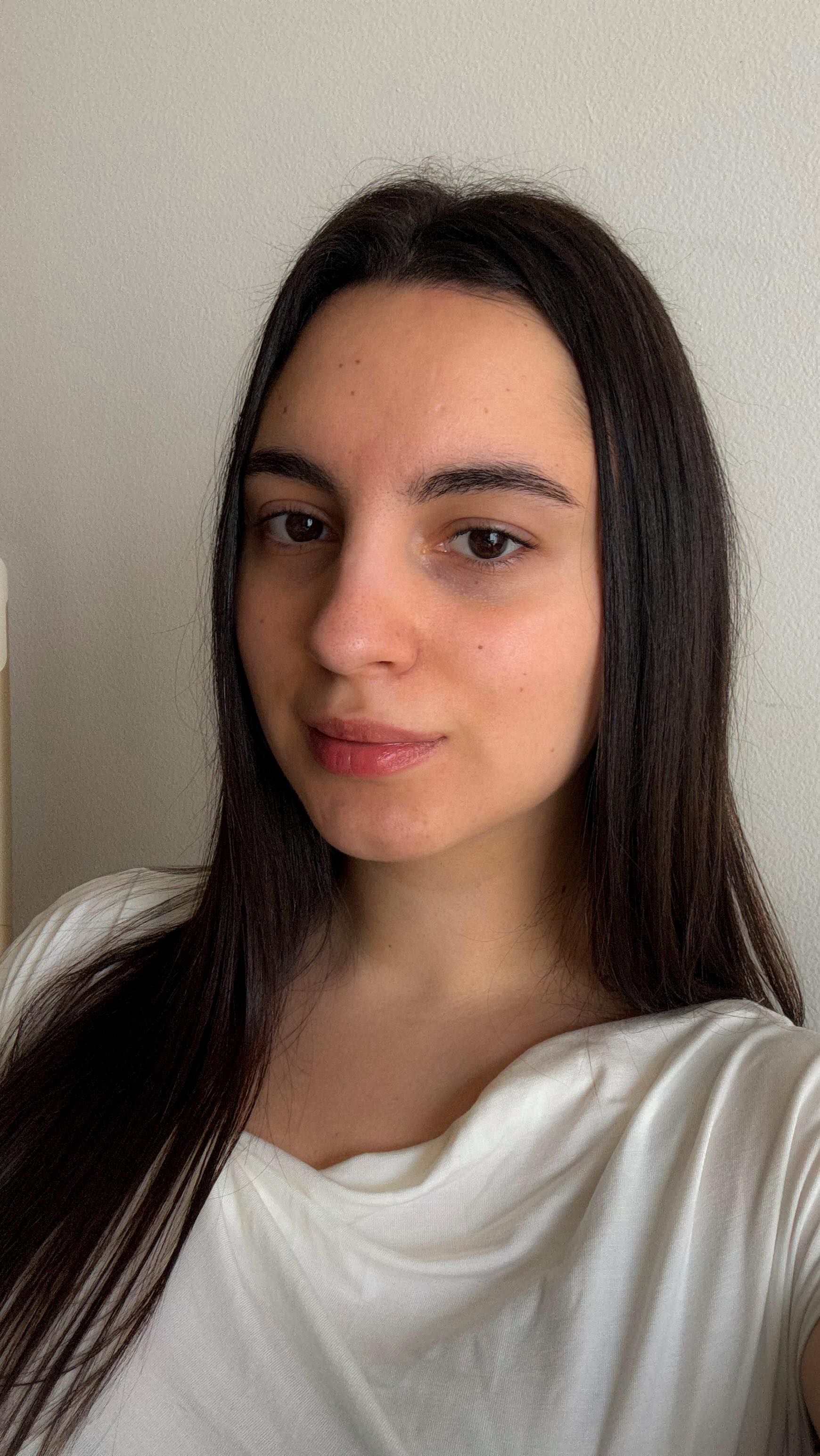 Instagram post by @v.e.tr.o.v.a for DERMAFIRM. Caption reads: gifted by Dermafirm 

My skin’s never looked....