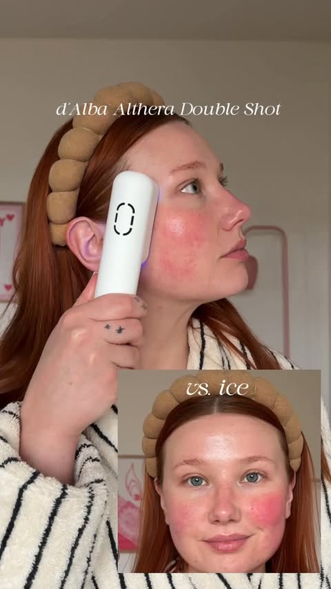 Instagram post by @b1gbimbo for dalbaglobal. Caption reads: I’ve been cooling my redness instantly with the....