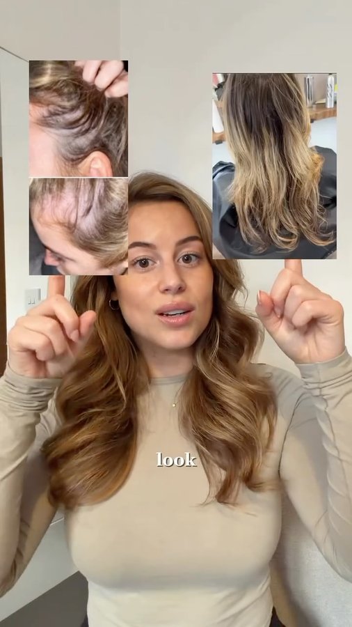 Instagram post by @sophiehlbrown for Hair Syrup. Caption reads: my hair regrowth journey + recommendations 

*none....