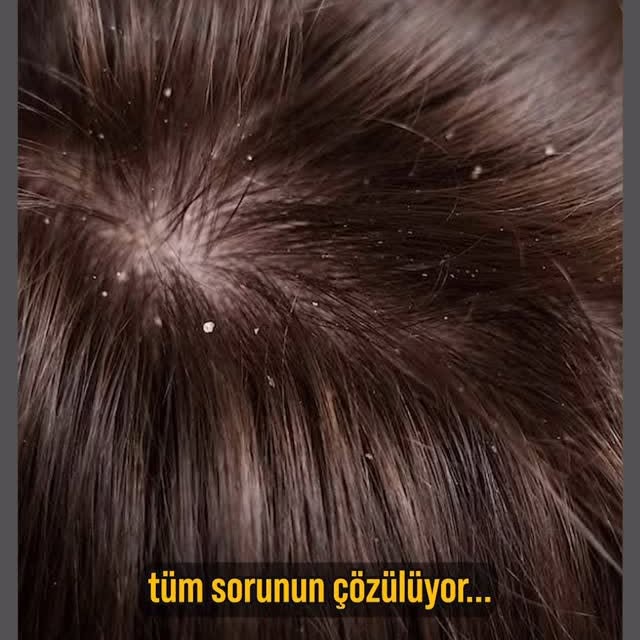 Instagram post by @spunkram for Head&Shoulders. Caption reads: #işbirliği Photoshop’a gerek kalmayan o kepeksiz....