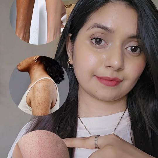 Instagram post by @adittijoshi11 for Dove India. Caption reads: If you are genuinely looking for a bodywash for....