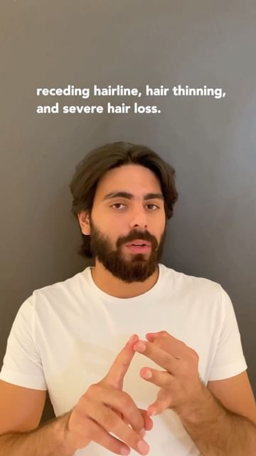 Instagram post by @karanjoshann for HealthKart. Caption reads: DHT is a common reason for both, male pattern....