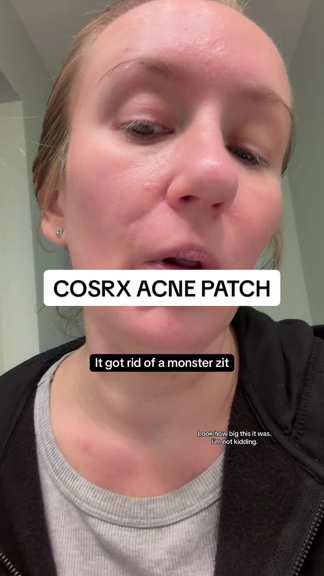 TikTok post by @tamie.konzier for COSRX. Caption reads: [...] best acne patch I have tried. @COSRX US....