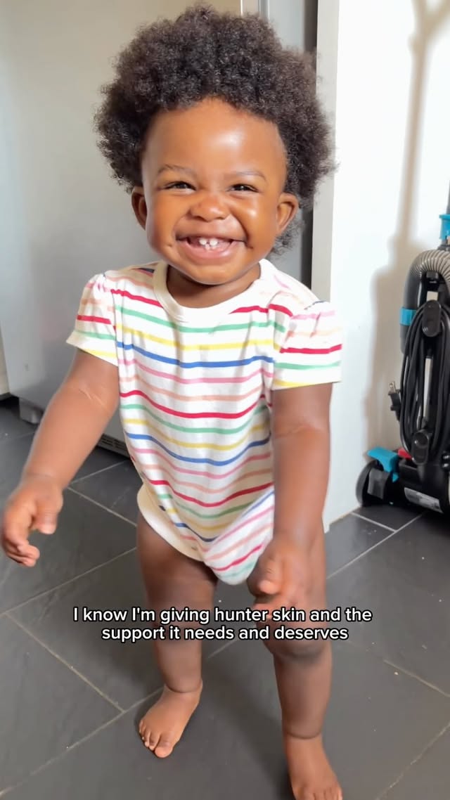 Instagram post by @healing_monet for ATOPALM. Caption reads: [...] baby girl comfortable this summer ☀️🧴....