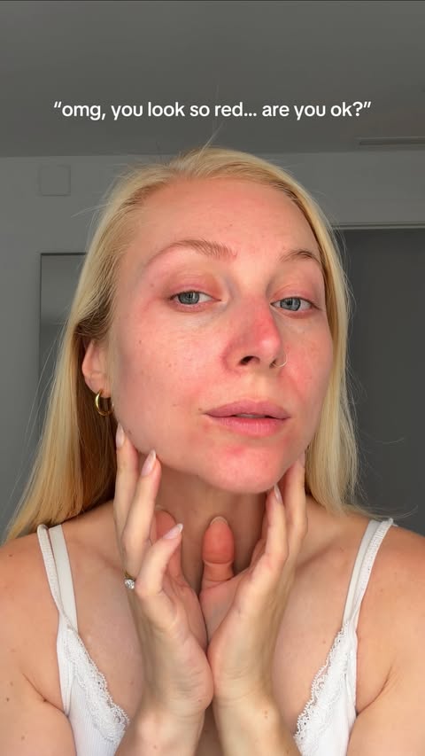 Instagram post by @billieblonde_ for Mamonde. Caption reads: [...] routine to ease redness instantly… 🤌⬇️....
