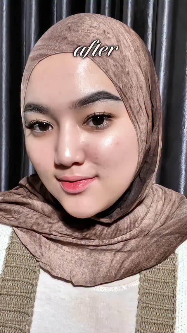 Instagram post by @dwiffahraherz for ELSHESKIN. Caption reads: [...] now 💫 with RETINAL Advance Serum from....