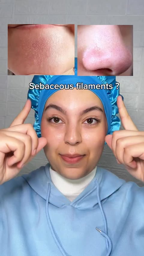 Instagram post by @skinby.zosia for LANEIGE. Caption reads: Skin solutions for skin concerns 

➡️....