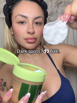 TikTok post by @priscilla.sweetz for JiYu Skin. Caption reads: Dark spots + dull skin? 👀 These JIYU toner pads....