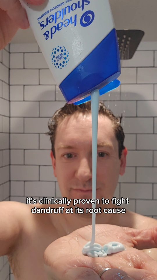 Instagram post by @denverskindoc for Head&Shoulders. Caption reads: #ad Break the dandruff cycle for good with Head &....