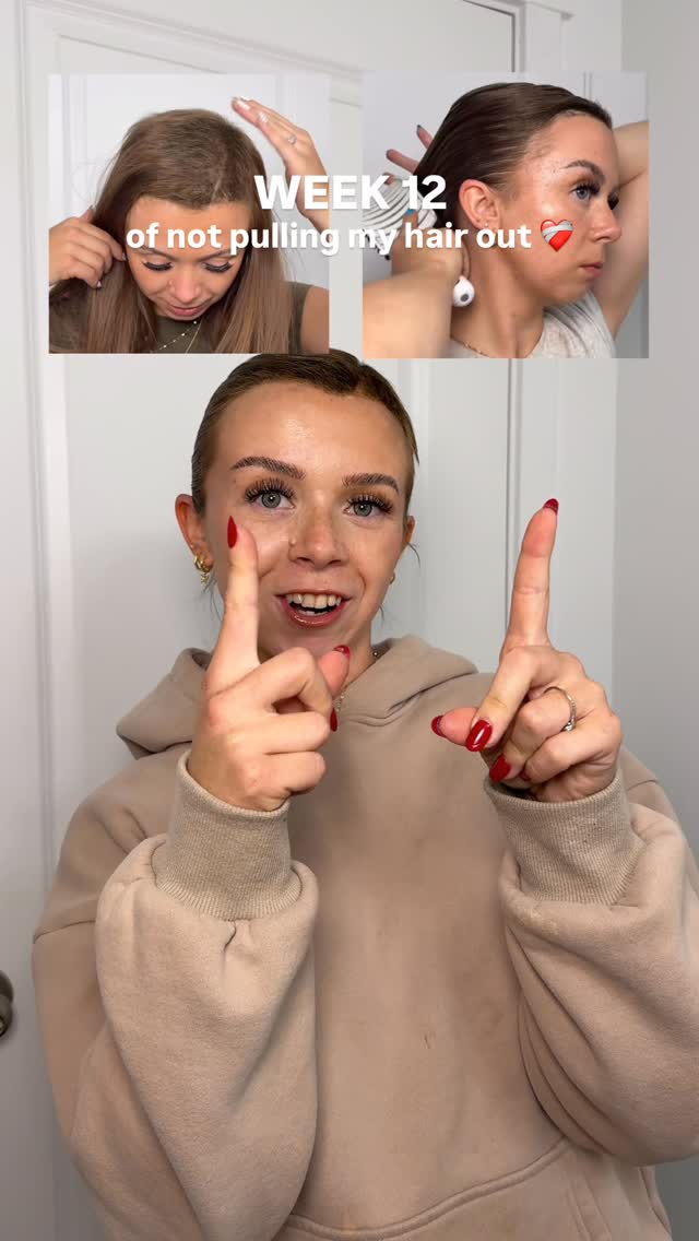 Instagram post by @shaylagressman for Toppik. Caption reads: WEEK 12 ❤️‍🩹 the regrowth phase is....