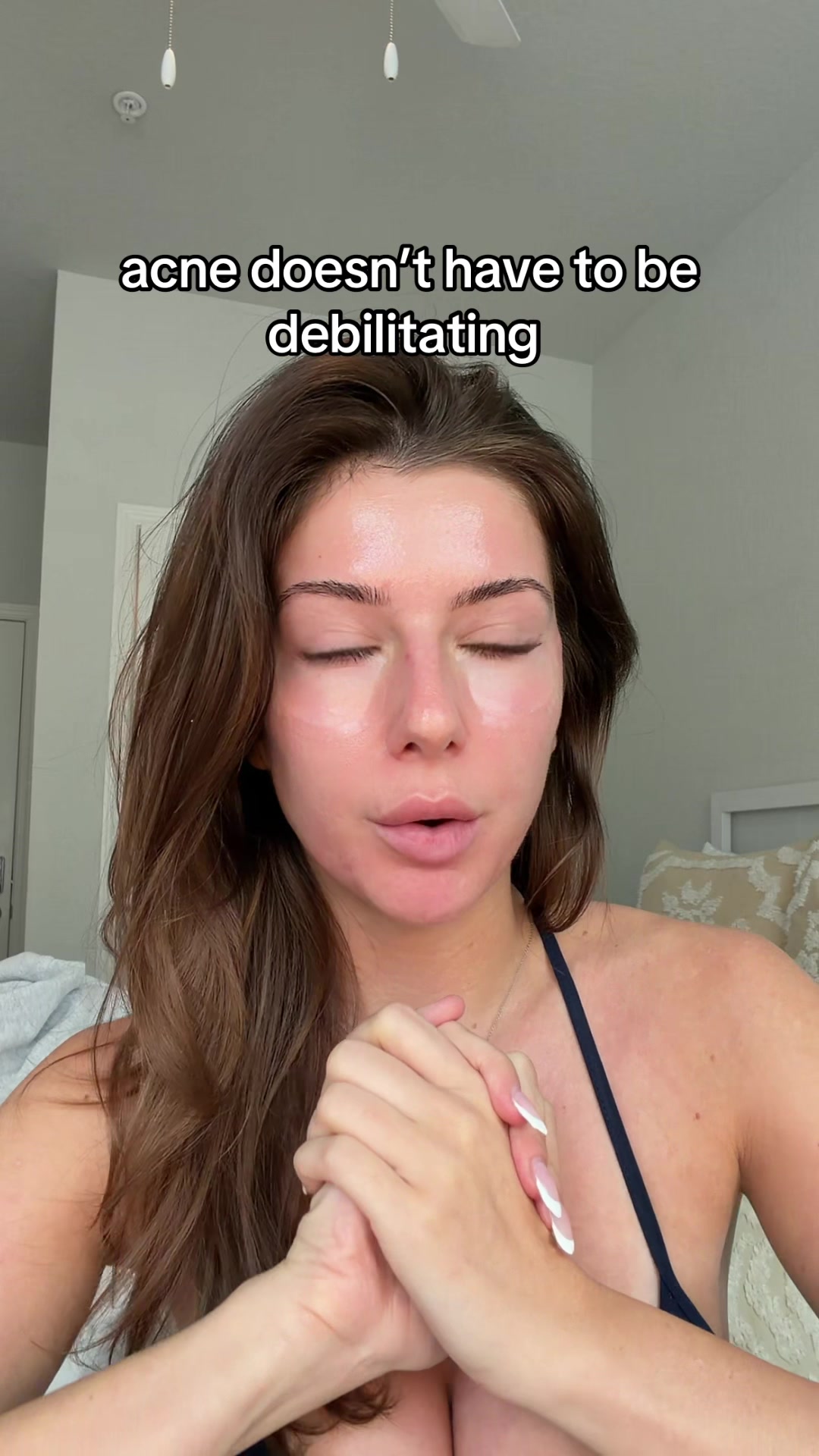 TikTok post by @kendallshops for CLEARSTEM Skincare. Caption reads: [...] 🫰✨ #acne #skincare #hormonalacne....