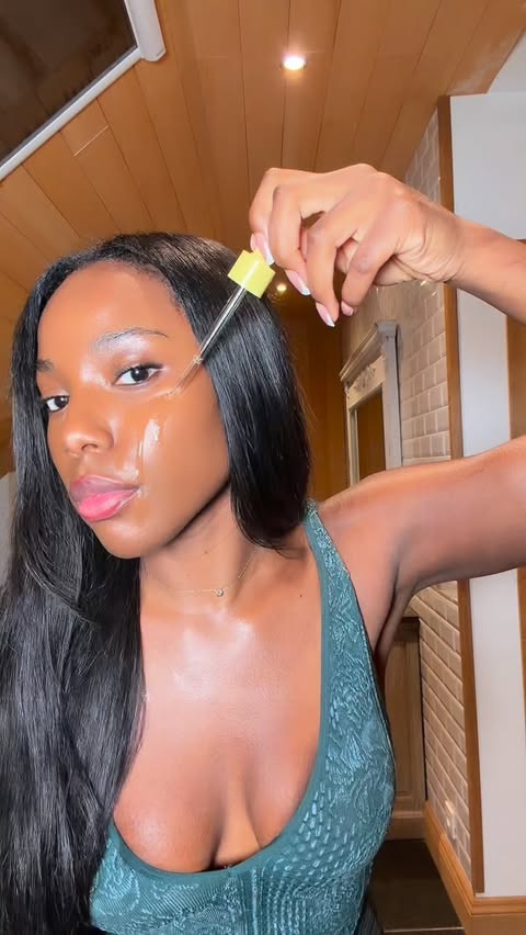 Instagram post by @garbi.d for APRILSKIN. Caption reads: [...] #darkspots #hyperpigmentation #APRILSKIN....