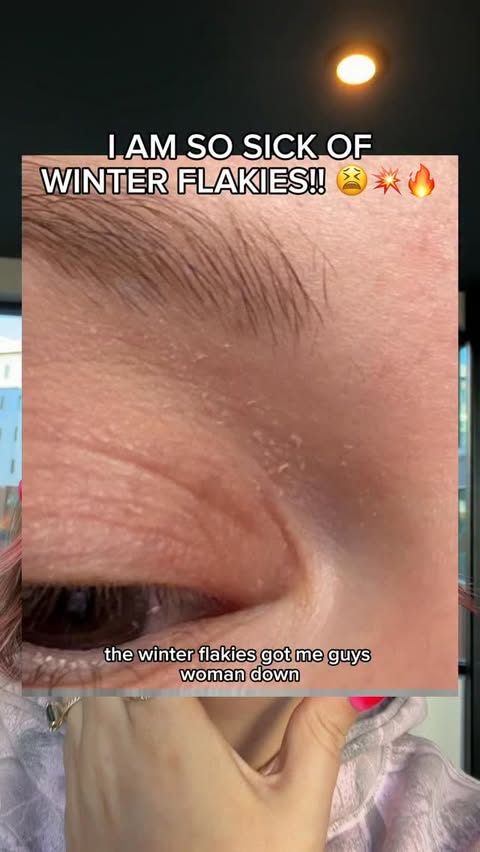 Instagram post by @hydrationceo for First Aid Beauty. Caption reads: [...] SAVING my crispy winter skin!....