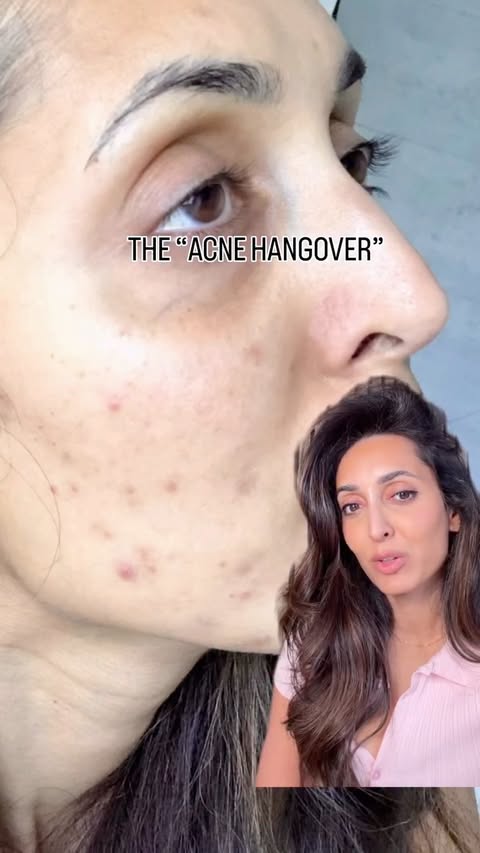 Instagram post by @drpyal for Amazon. Caption reads: [...] for all skin types. Available now on @amazon....