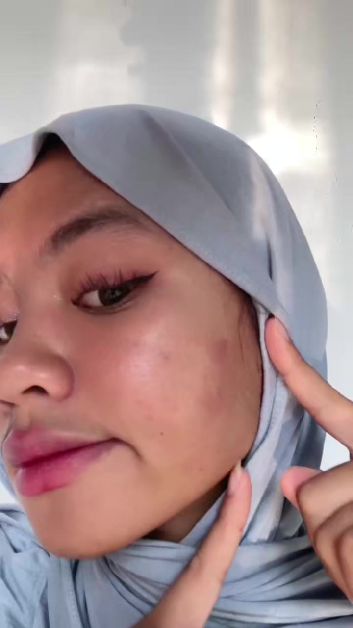 TikTok post by @anjanika.putri for Nurilab.id. Caption reads: [...] #SerumConcealer #ObatJerawat @Nurilab.id.
