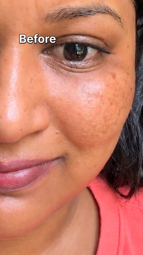 Instagram post by an influencer for The Derma Co. Caption reads: [...] Comment “SERUM” for link 🔗 @thedermacoindia.