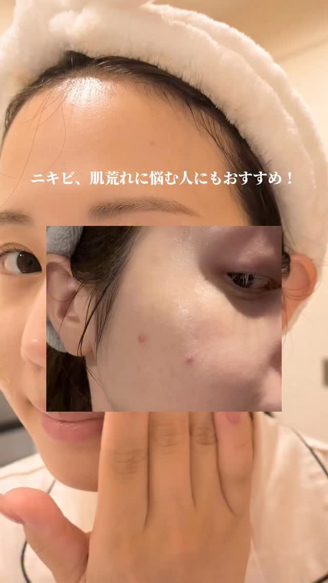 Instagram post by @__mami.912 for Skin1004. Caption reads: SKIN1004から出たティーツリカラインが登場✨
鎮静*効果があるから揺らぎがちな肌におすすめ！
....